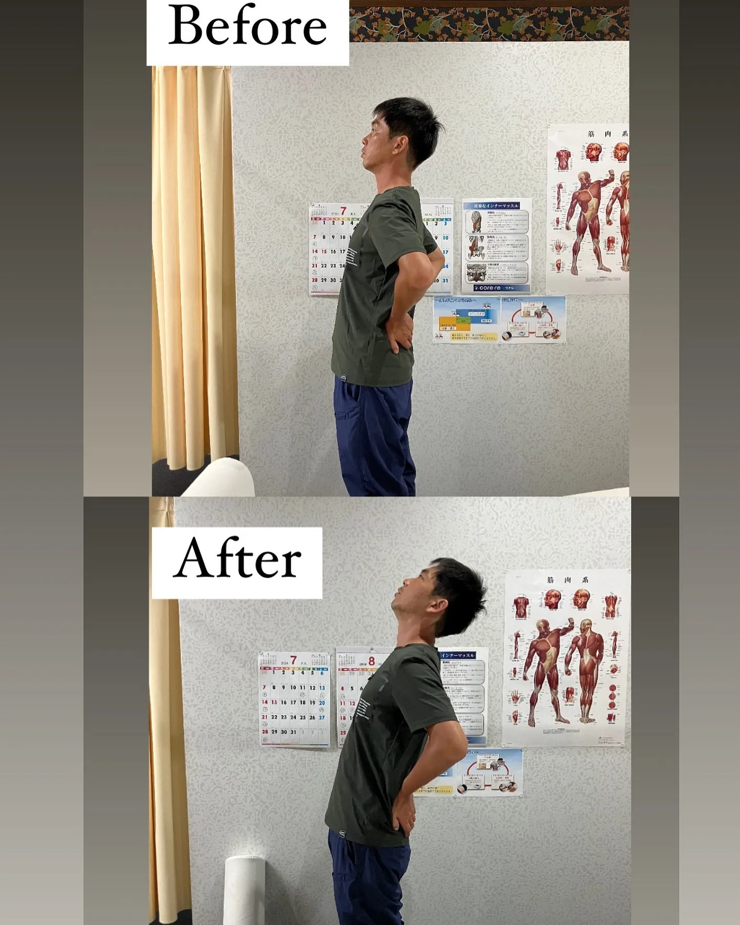 30代男性のギックリ腰のBefore⇨After