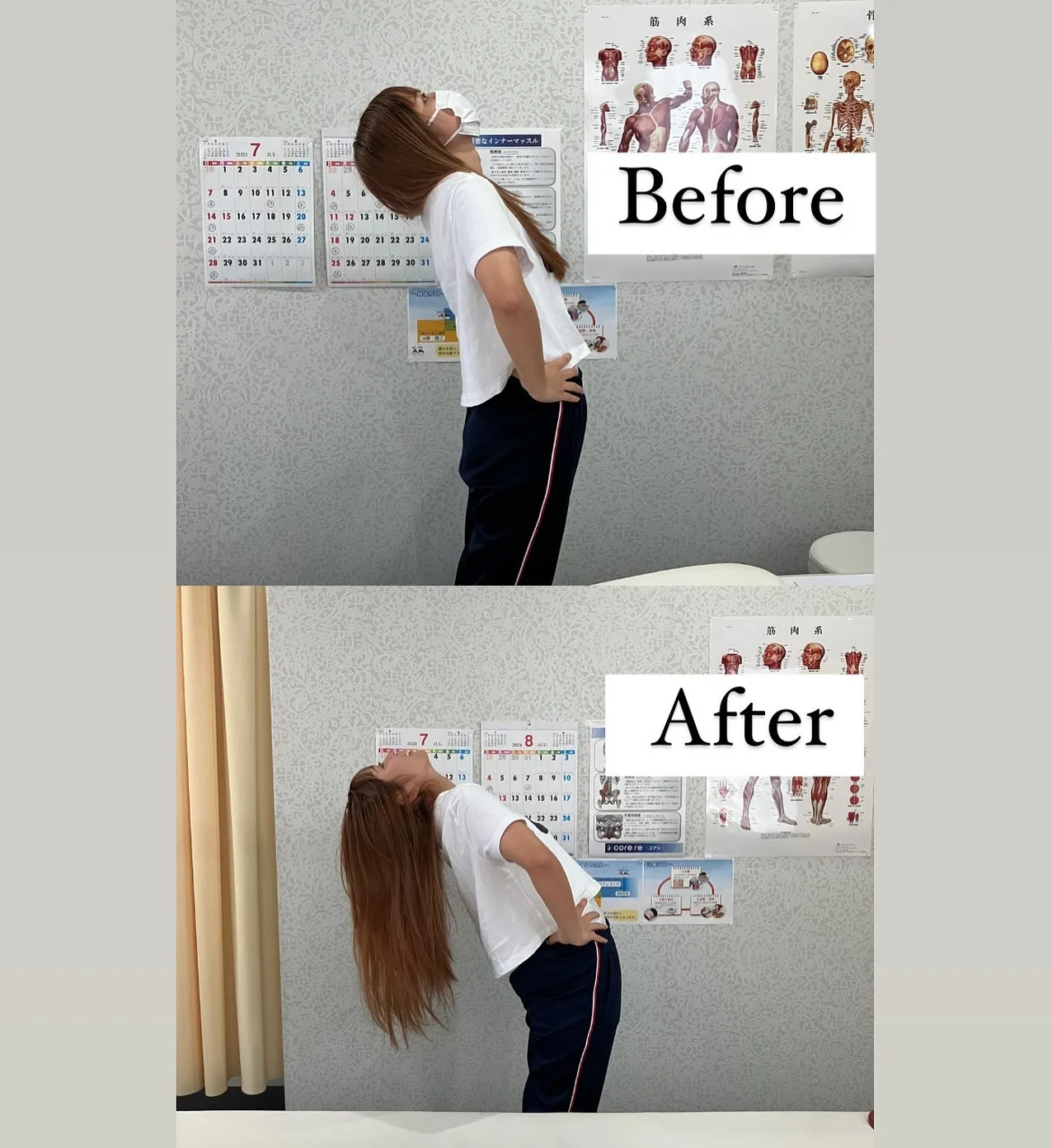 女子大学生、腰可動域のBefore⇨After❗️