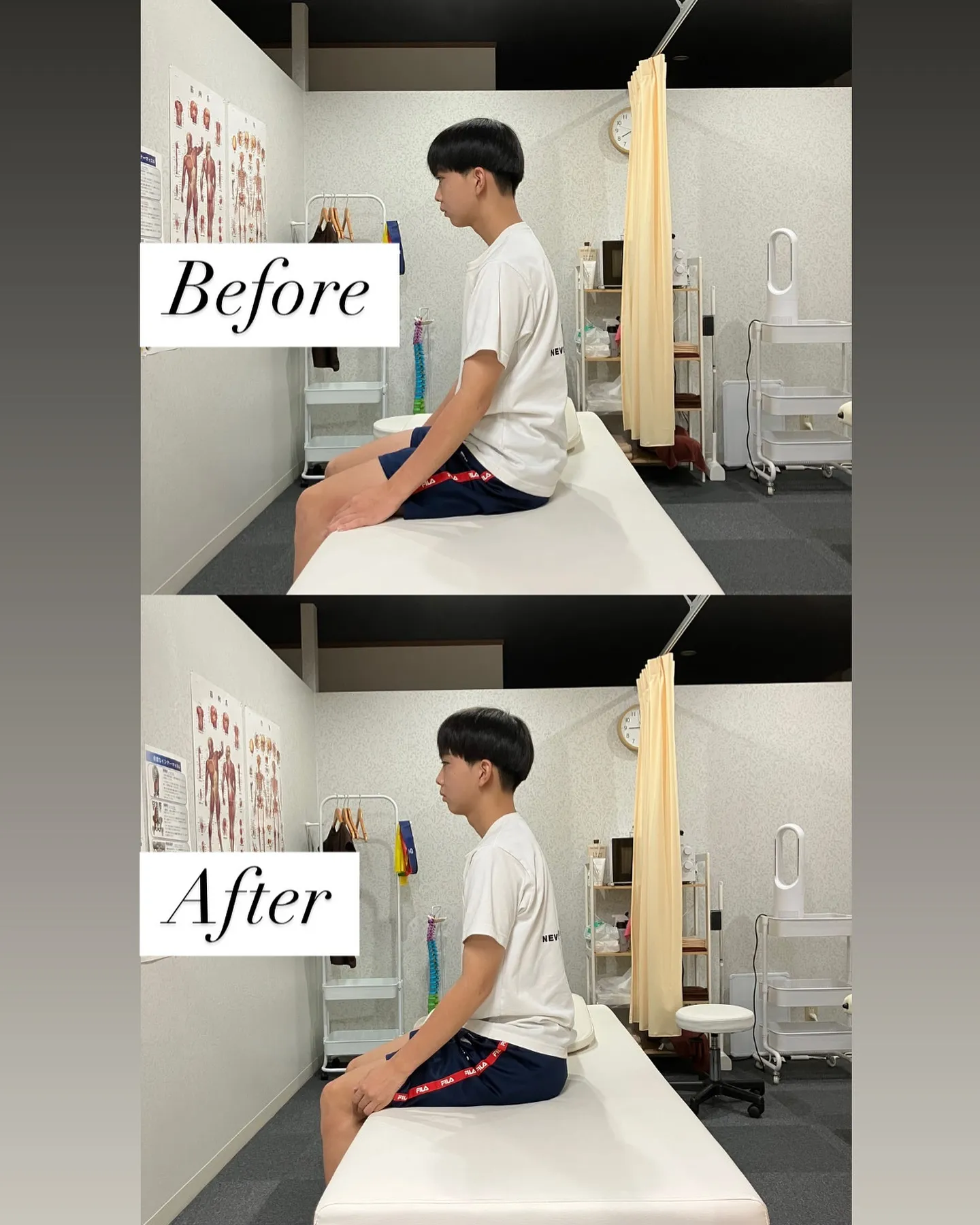 男子中学生の姿勢改善Before⇨After❗️