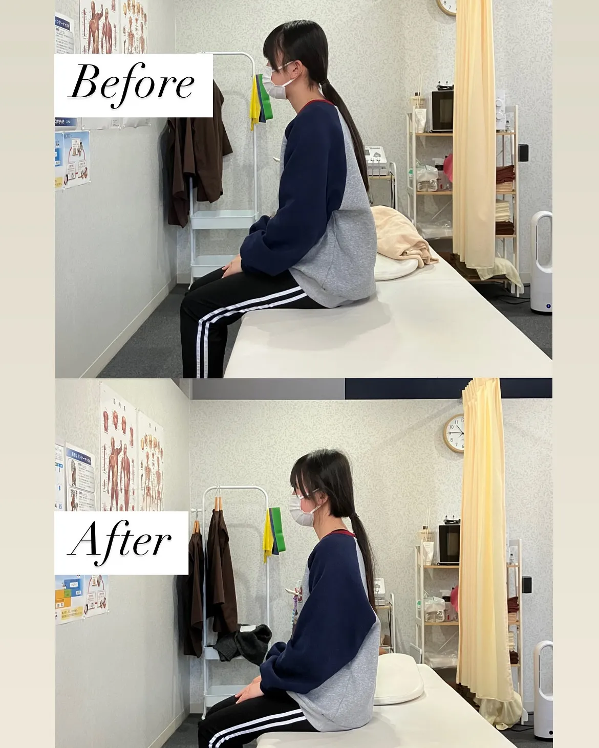 女子中学生の姿勢改善Before⇨After❗️