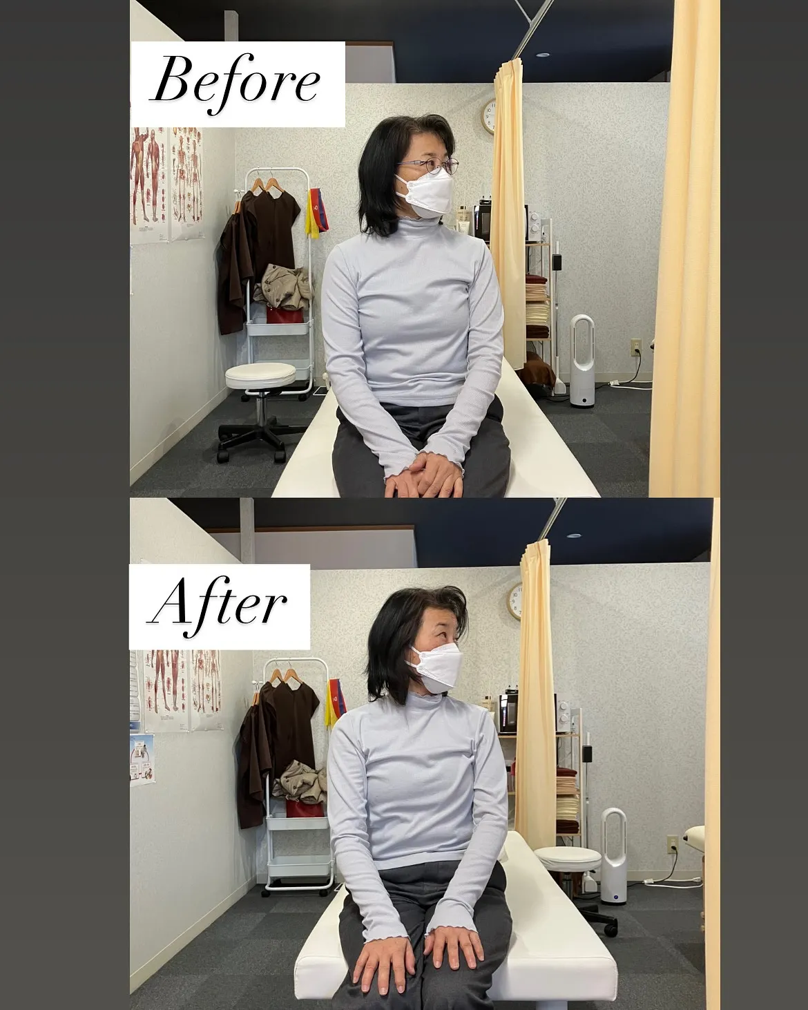 60代女性首可動域Before⇨After❗️