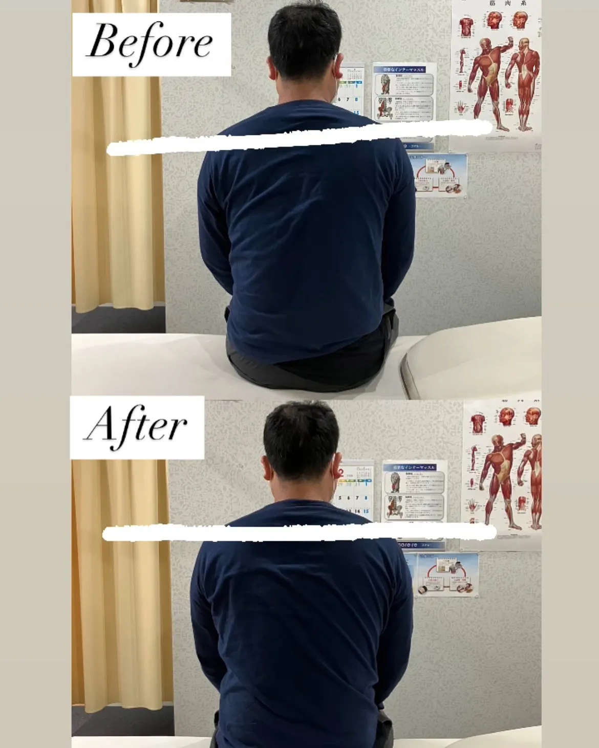 30代男性の姿勢Before→After❗️