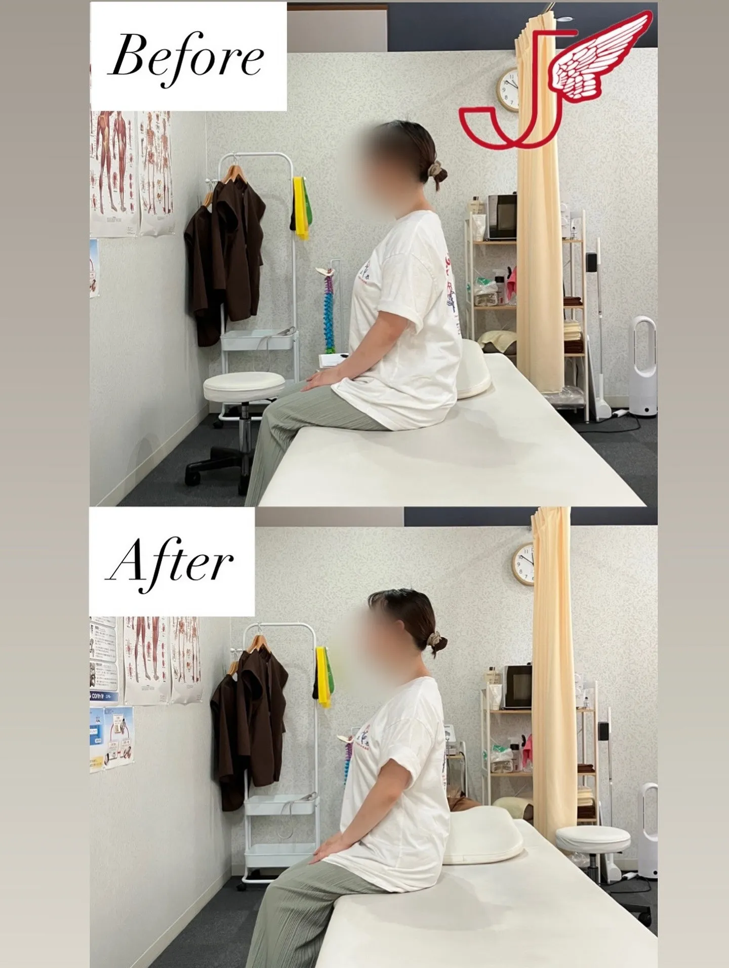 20代女性姿勢改善Before⇨After❗️