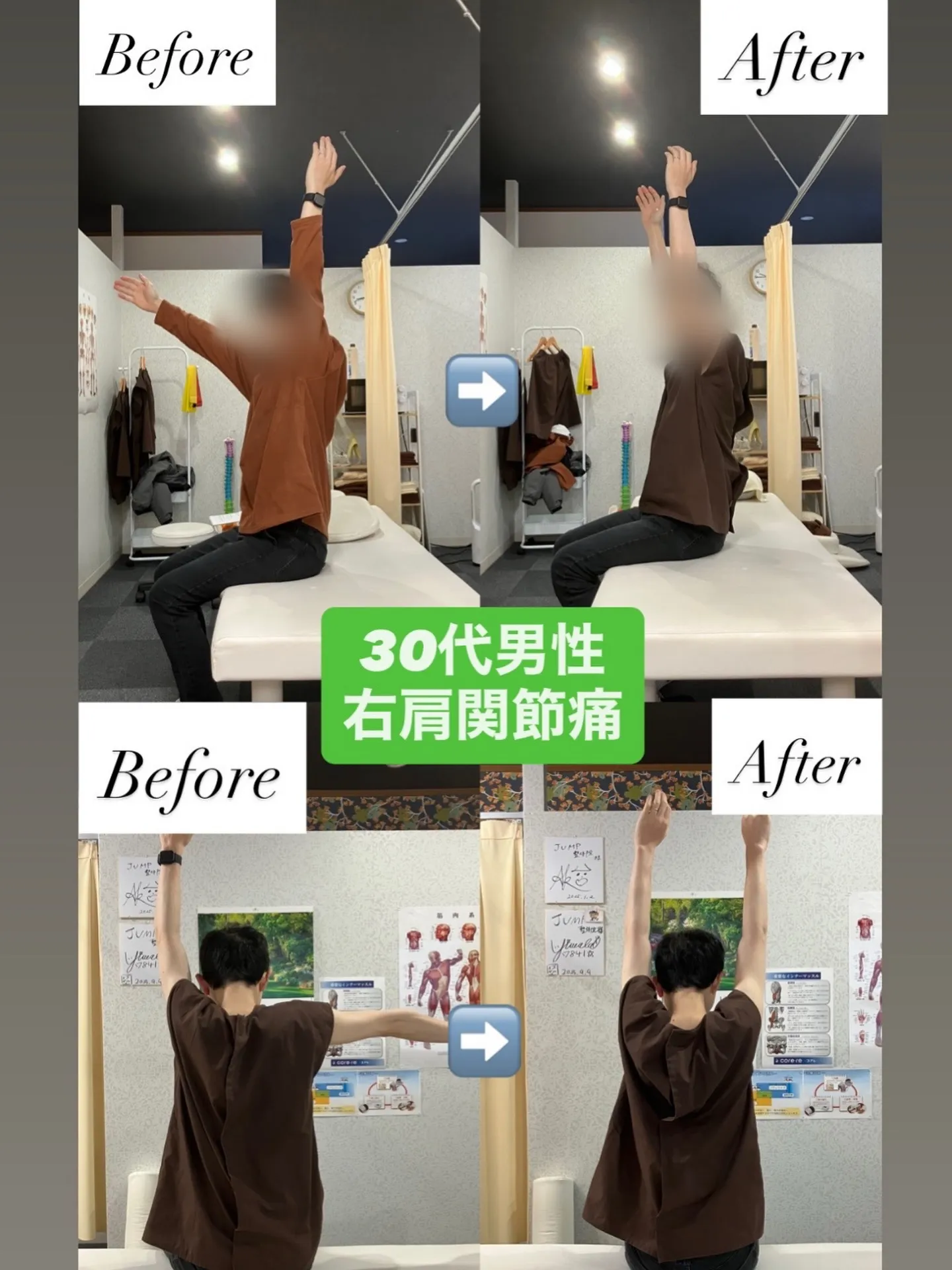 【30代男性／右肩の痛み】