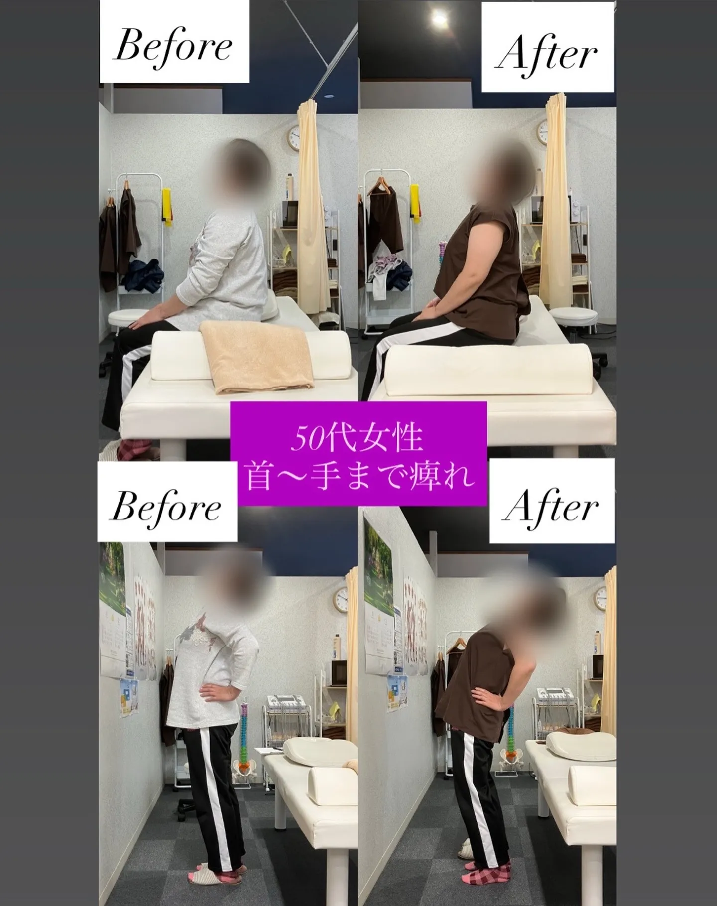 【50代女性／首〜腕のしびれ・腰痛】