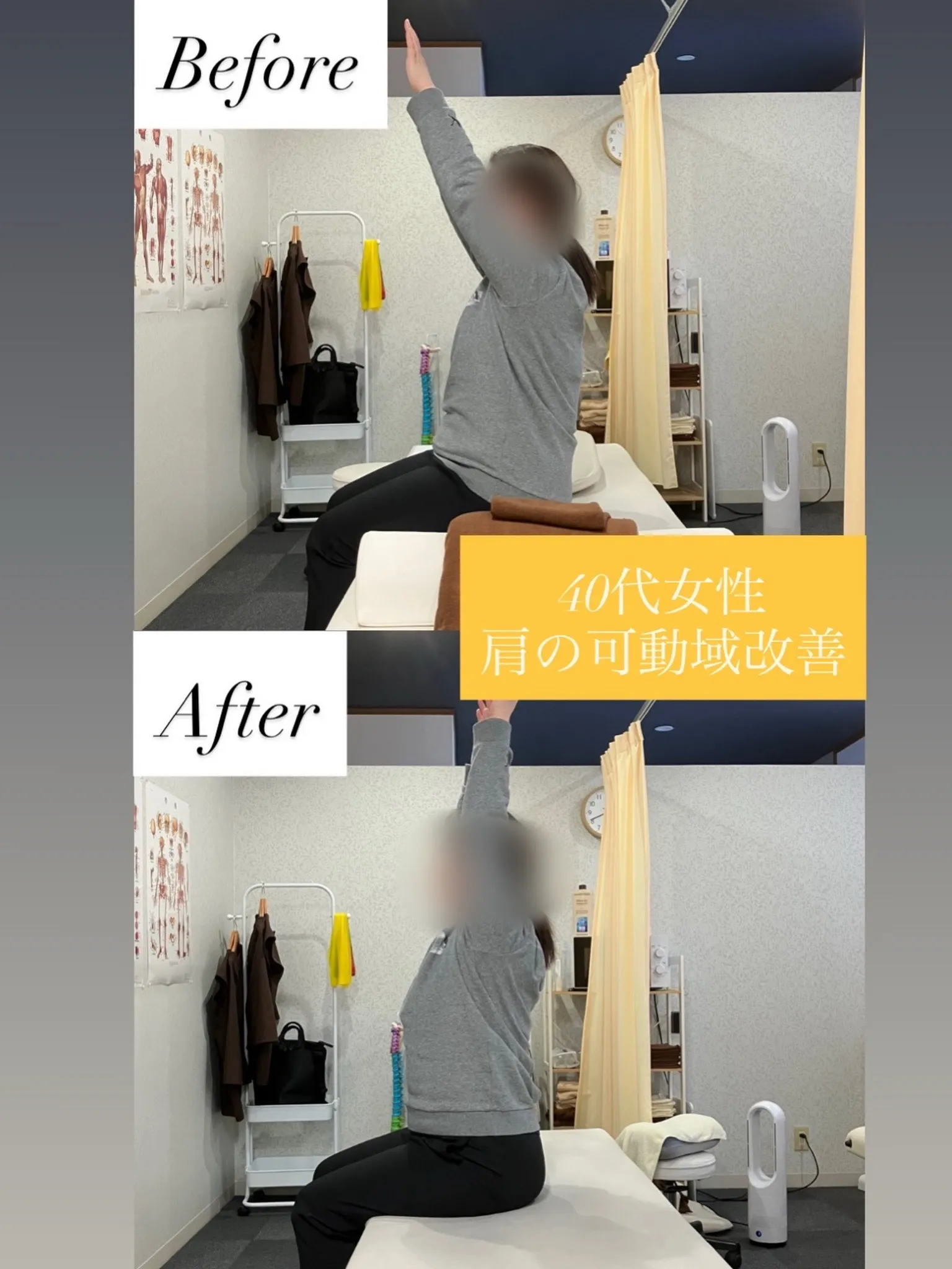 【肩〜背中の痛み / 左下肢の痛みでご来院】