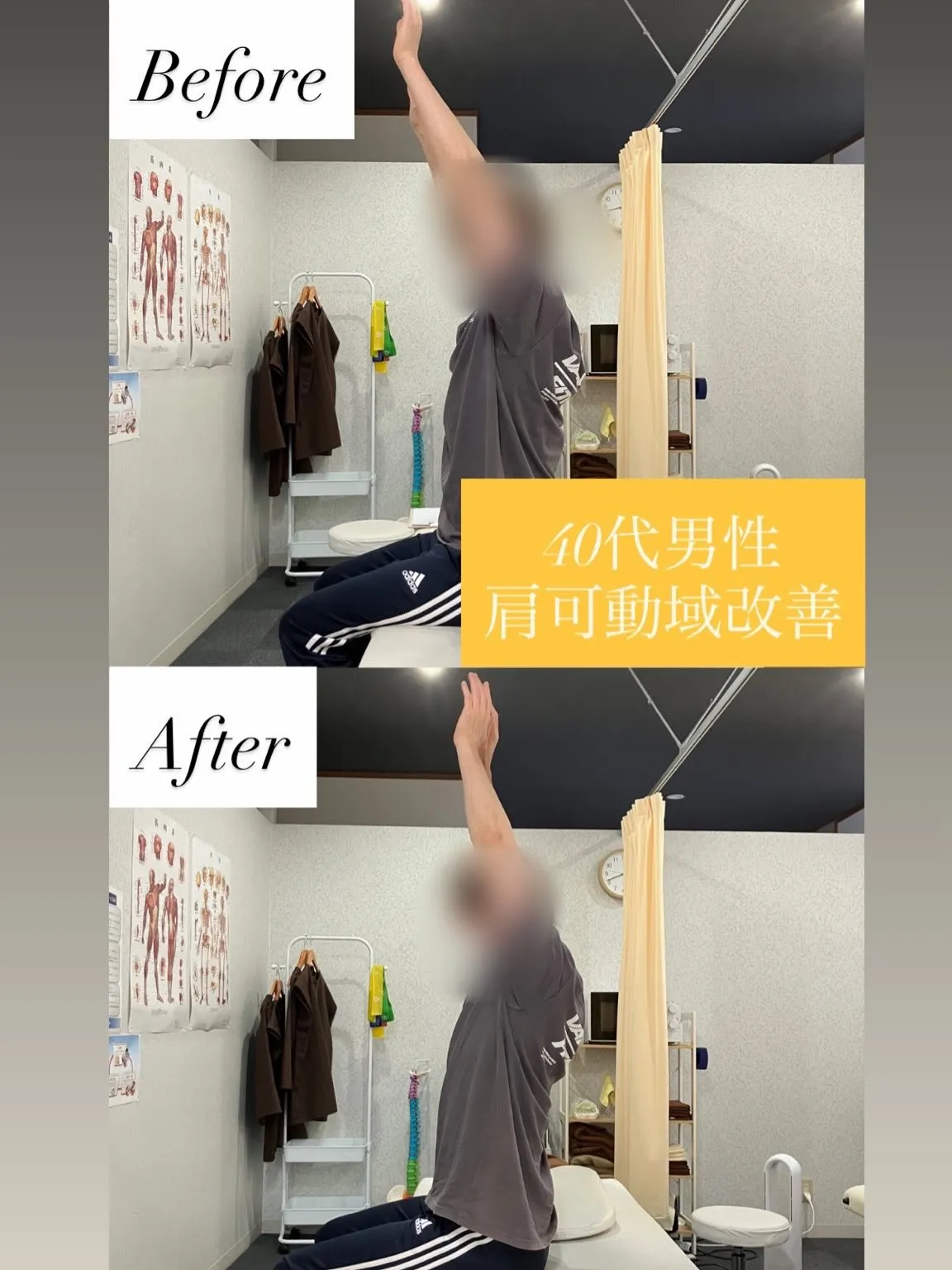 【40代男性｜肩可動域改善✨】