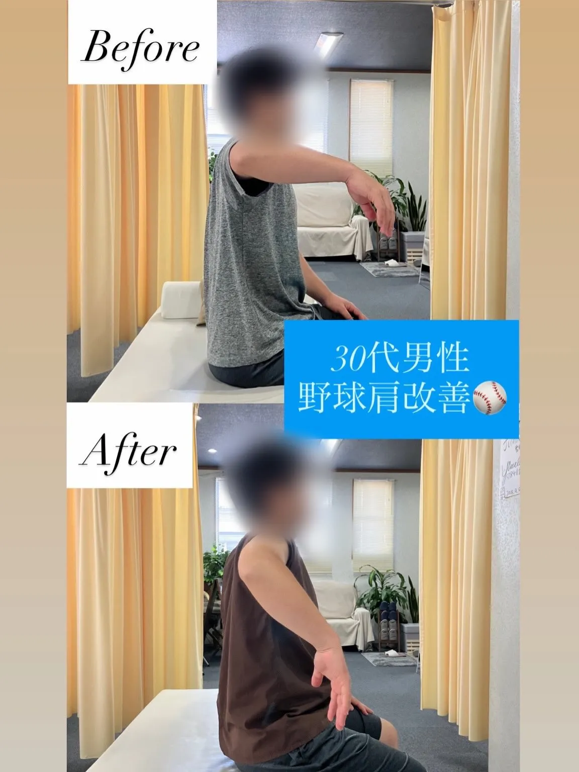 【30代男性｜投球時の肩の痛み改善⚾️】