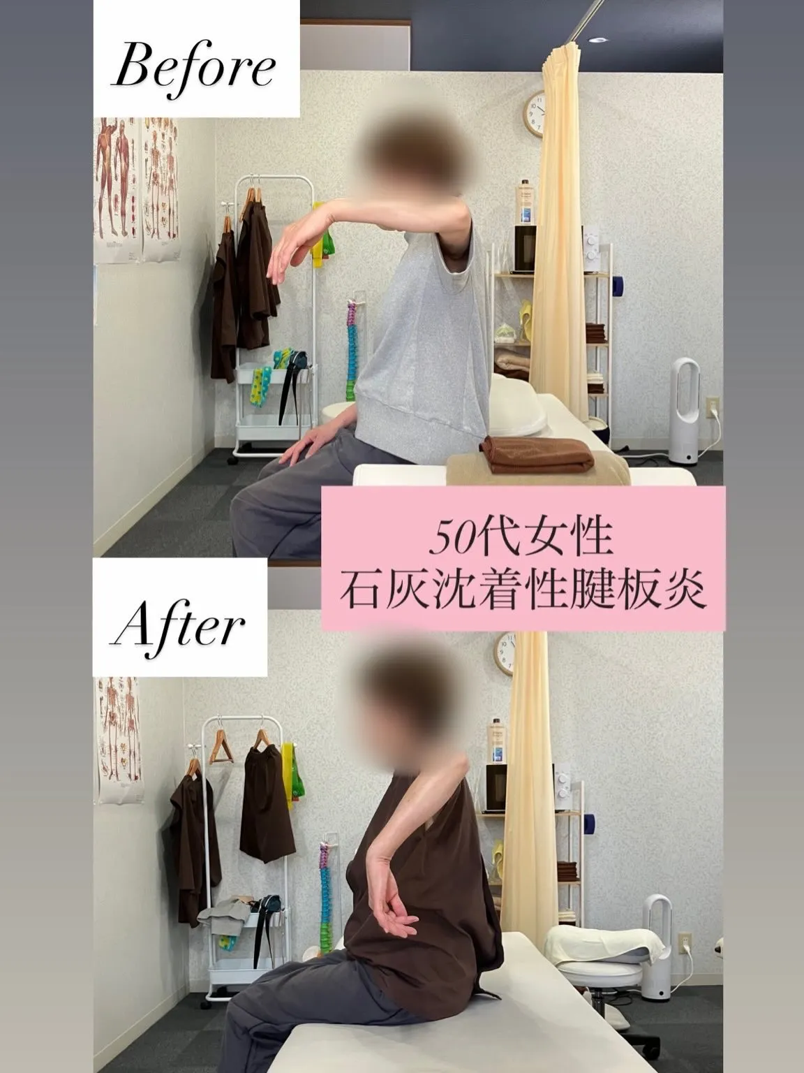 【50代女性｜肩の痛み改善✨】
